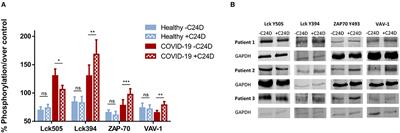 Downregulation of CD45 Signaling in COVID-19 Patients Is Reversed by C24D, a Novel CD45 Targeting Peptide